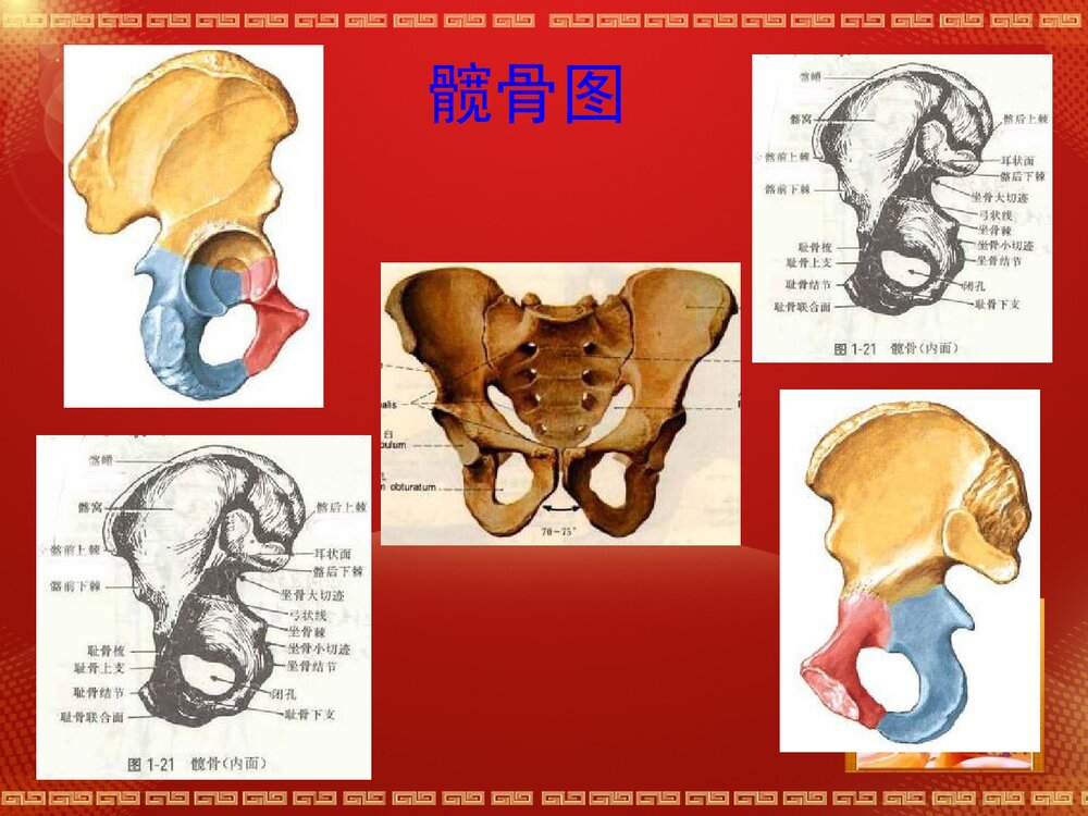 股骨头坏死解剖篇PPT课件9