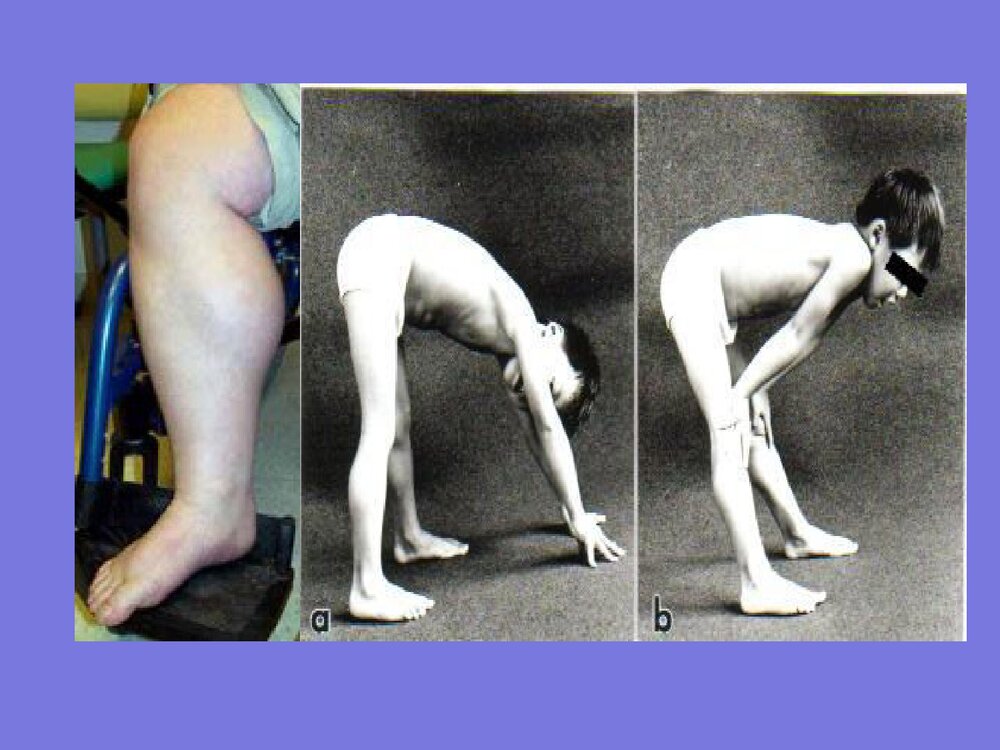 DMD基因诊断·进修生·给学生PPT课件下载5