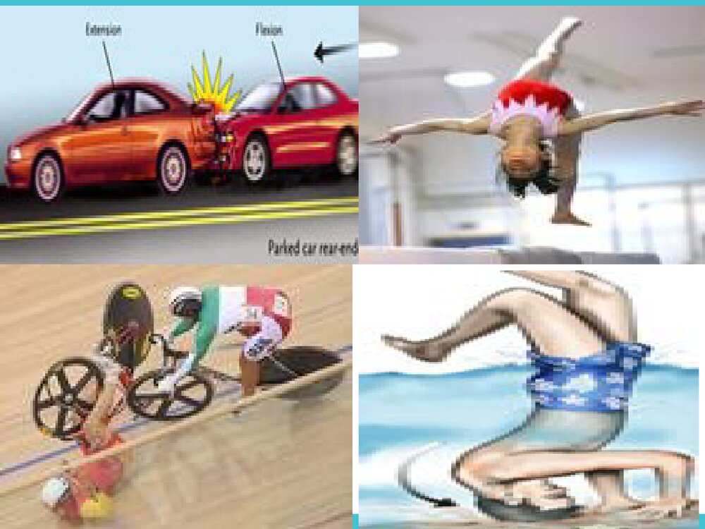 脊髓损伤截瘫平面的评估PPT课件下载9