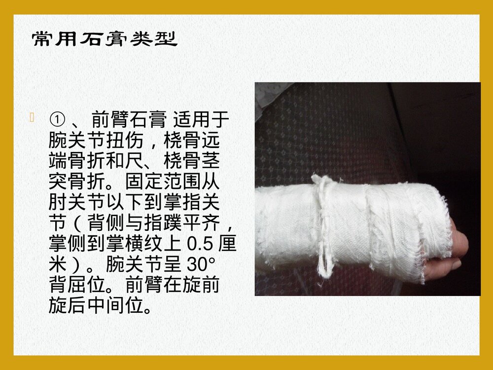 石膏固定护理常规PPT课件下载8