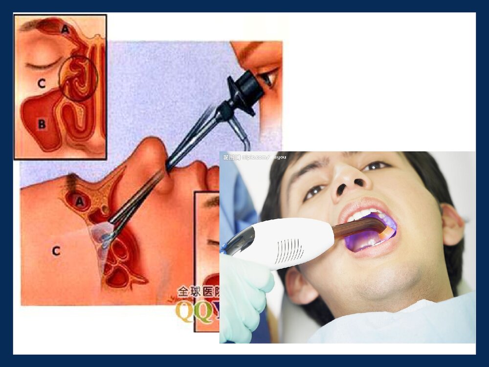 药物化学课程PPT《第二章 麻醉药 盐酸普鲁卡因的稳定性》8
