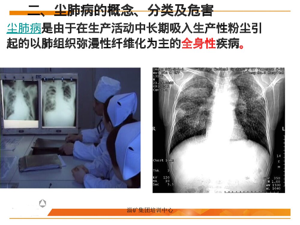尘肺全员培训PPT课件下载10