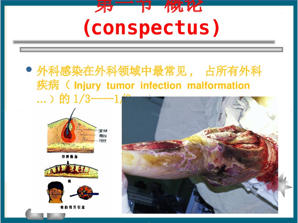 全身性外科感染PPT课件下载(共81页)2