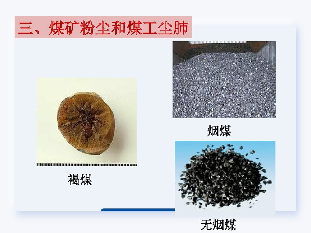 生产性粉尘与尘肺PPT课件下载2