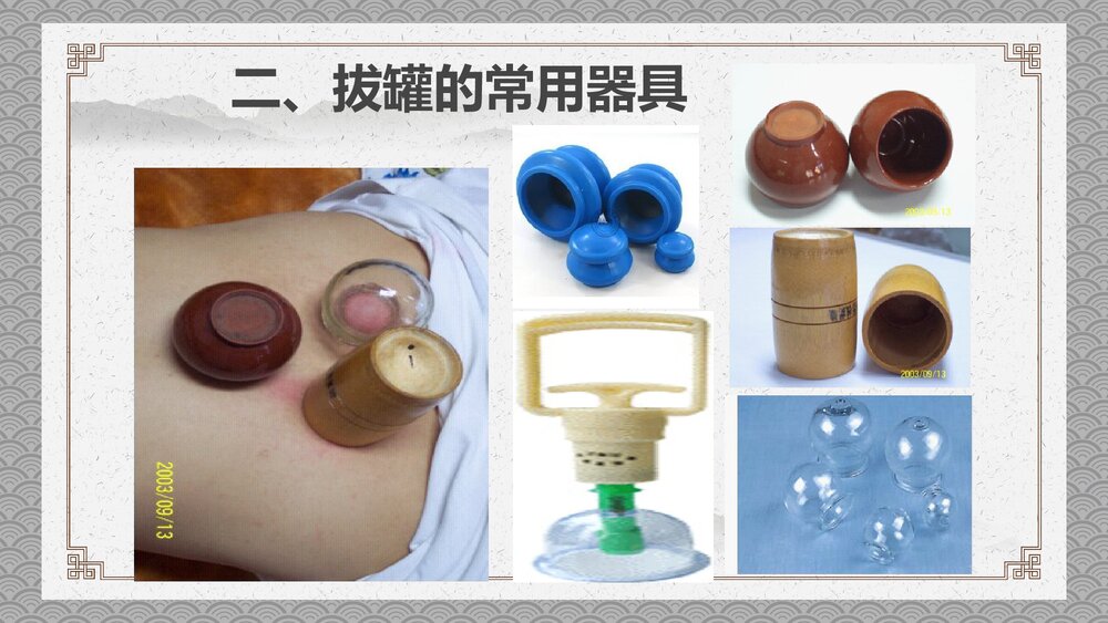 拔罐培训PPT课件4