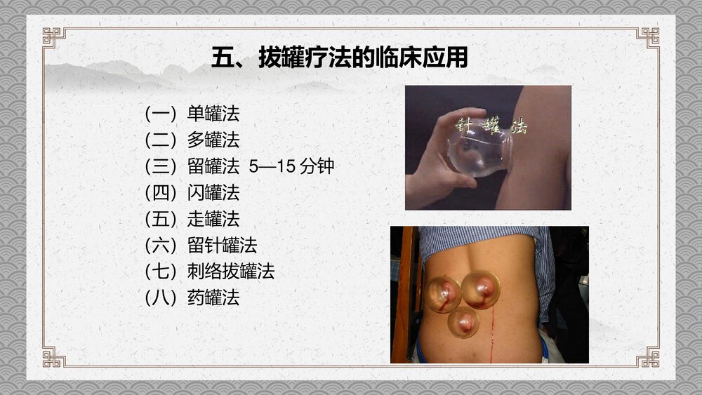 拔罐培训PPT课件8