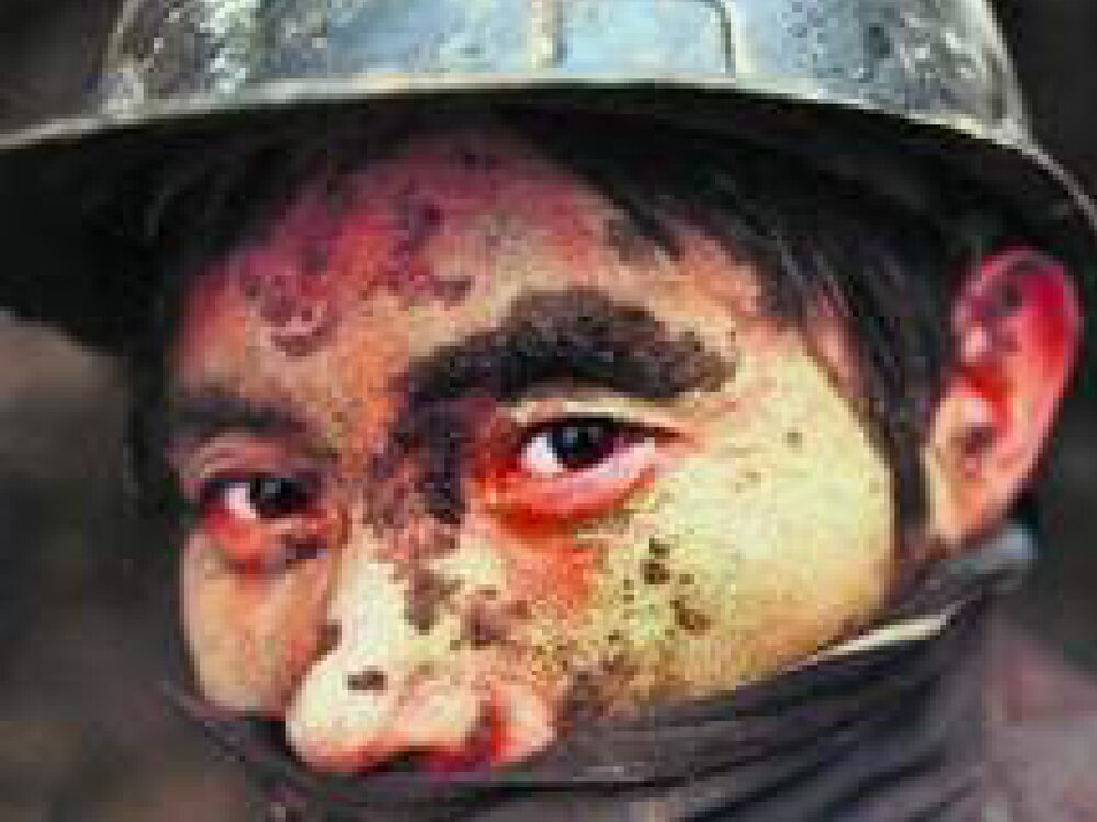 生产性粉尘与职业性肺部疾患PPT课件下载6