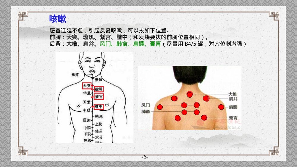 拔罐注意事项PPT课件下载8