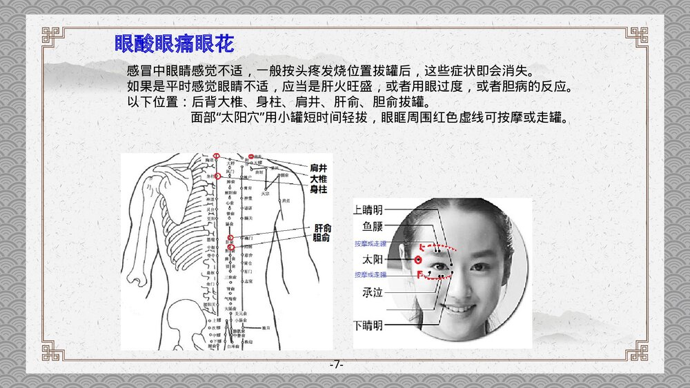 拔罐注意事项PPT课件下载9
