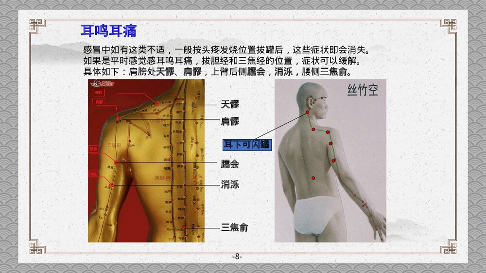 拔罐注意事项PPT课件下载10