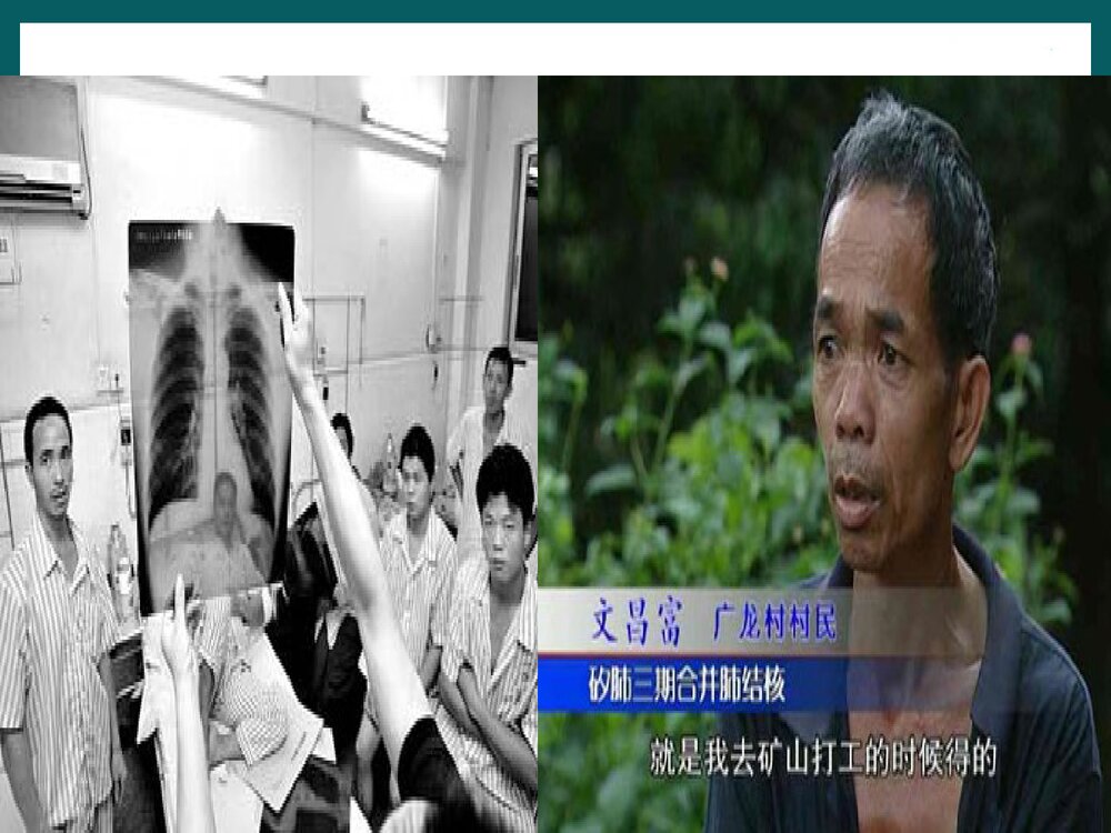 预防医学加强对尘肺病的认识PPT课件下载10