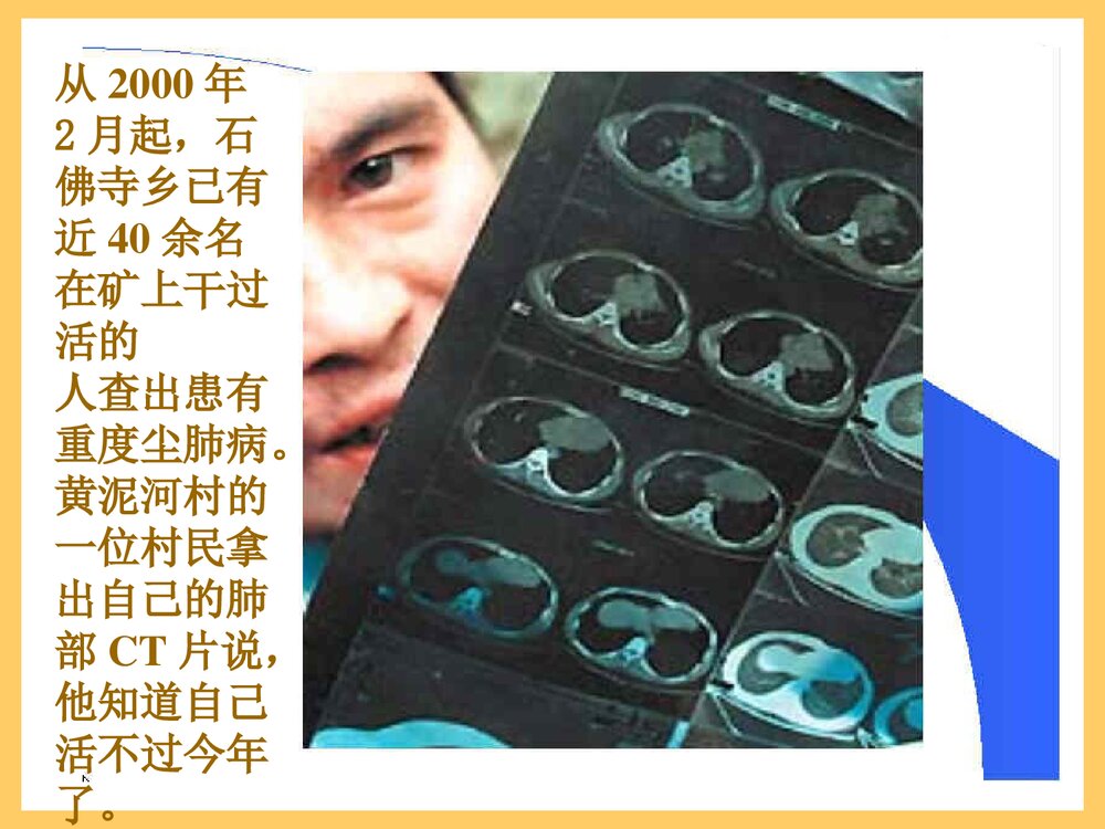 粉尘与尘肺PPT课件下载（共103页）10