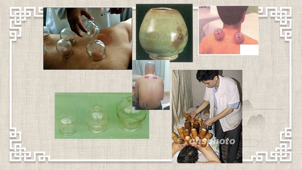 火罐疗法PPT课件下载5