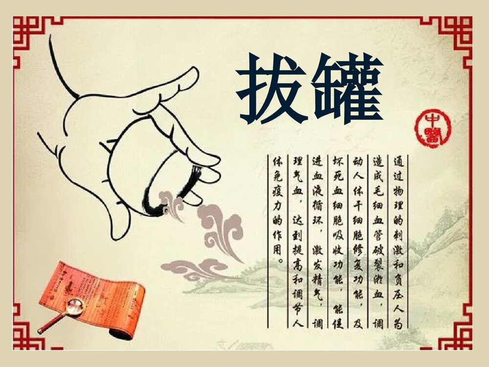 拔罐法的概述·操作方法·注意事项课件PPT下载1