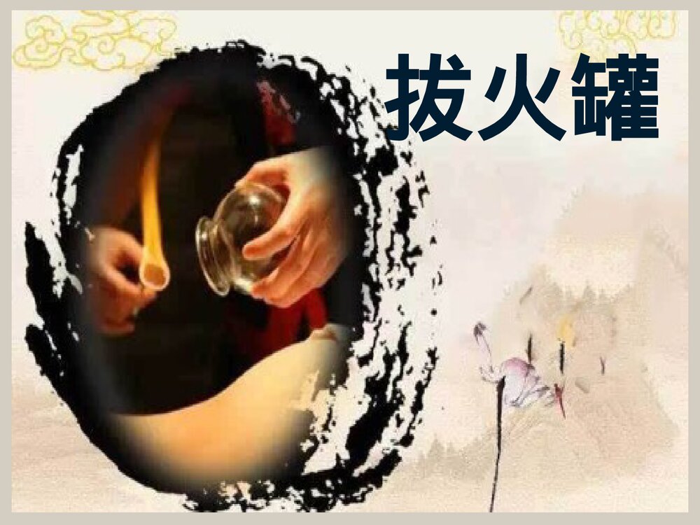 拔火罐PPT课件下载1