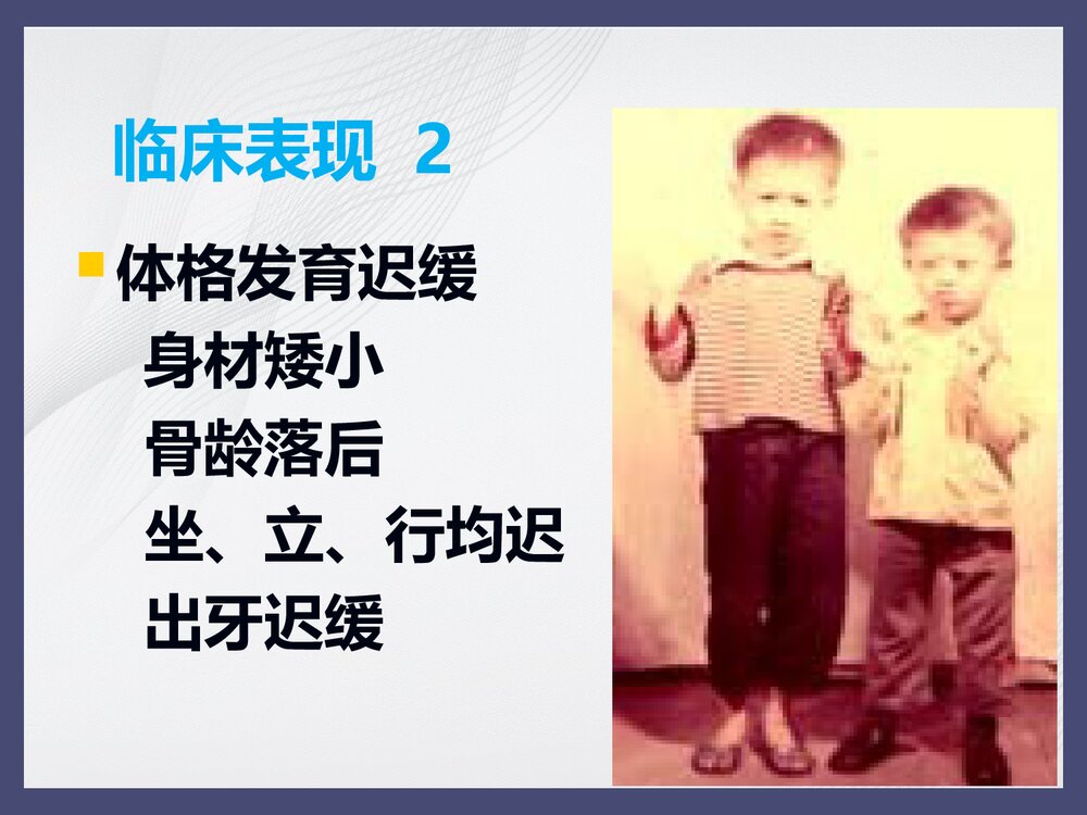 21三体综合征PPT课件下载(共28页·内容可修改编辑)10