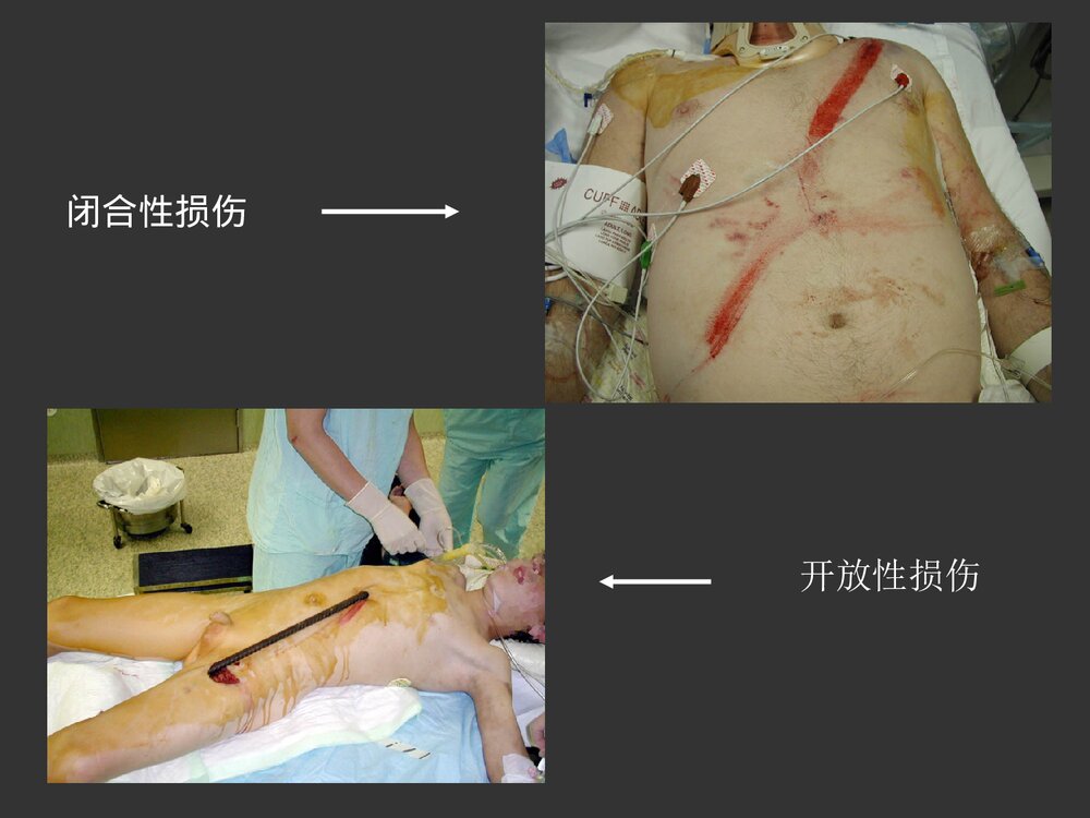 腹部损伤诊断治疗处理PPT课件下载4