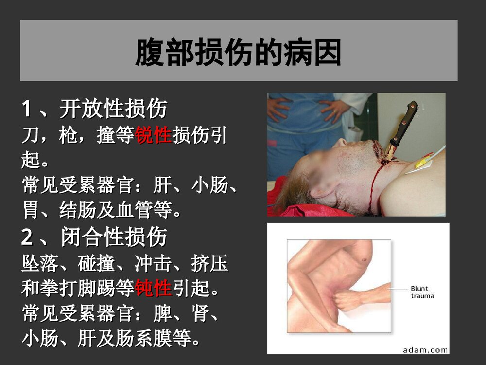 腹部损伤诊断治疗处理PPT课件下载6