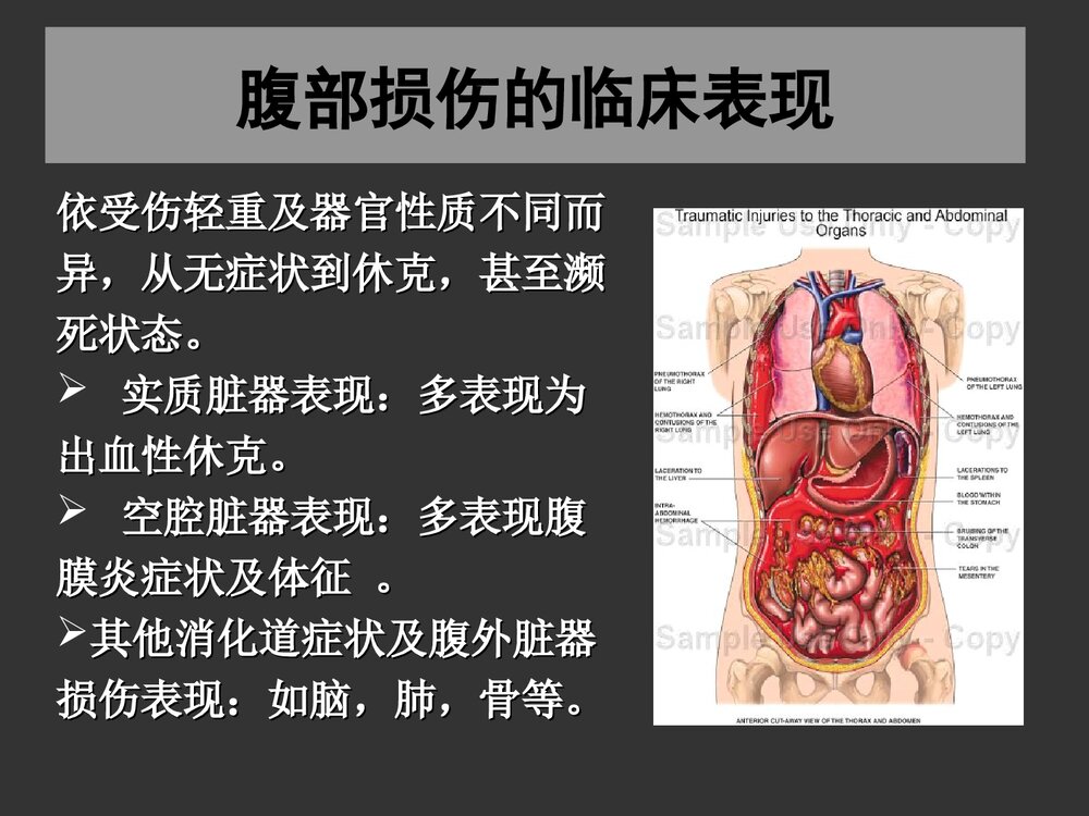 腹部损伤诊断治疗处理PPT课件下载7