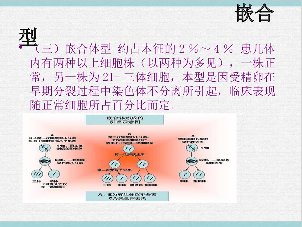 21三体综合征PPT课件下载10
