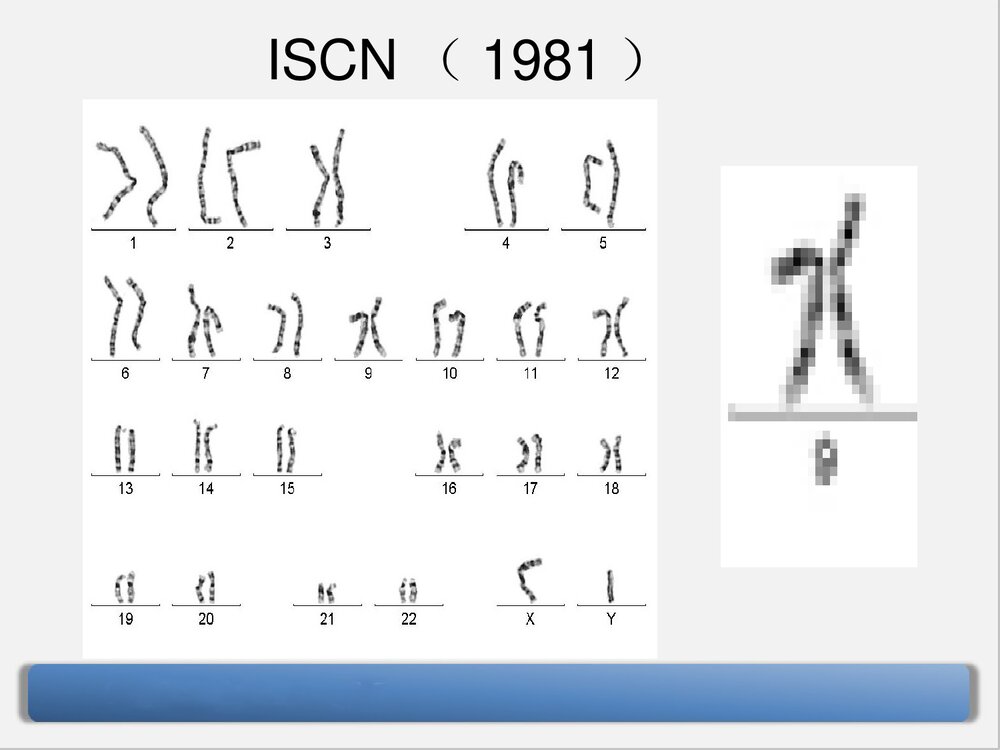 9号染色体三体嵌合型综合症PPT课件下载5