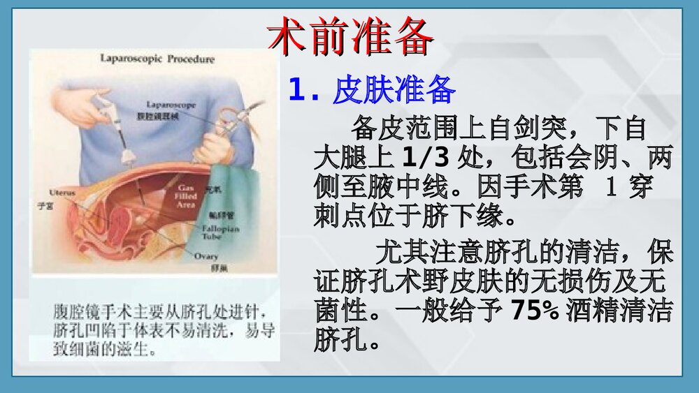 腹腔镜手术前后的护理PPT课件下载(共23页)5