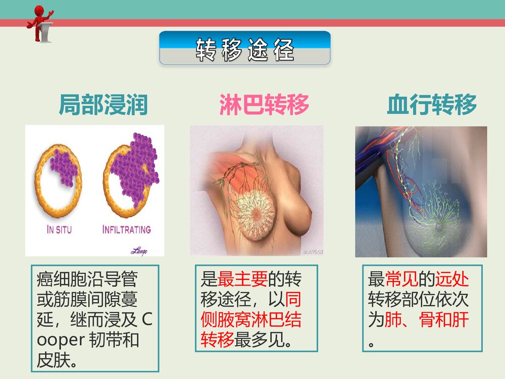 左乳腺癌患者的护理PPT课件下载6