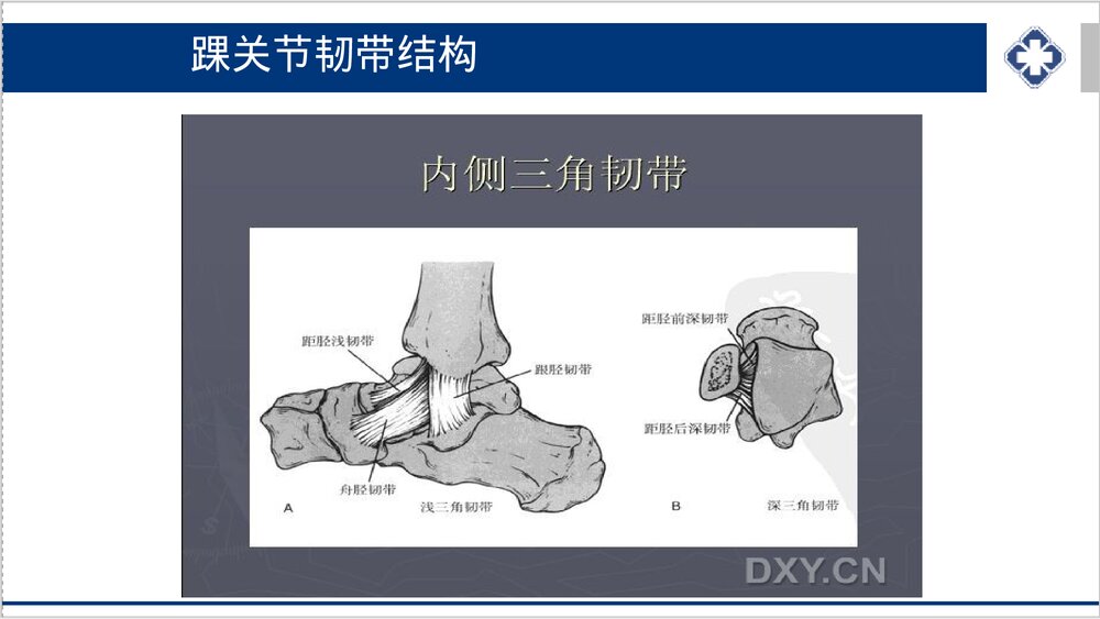 踝关节骨折的护理PPT课件下载9