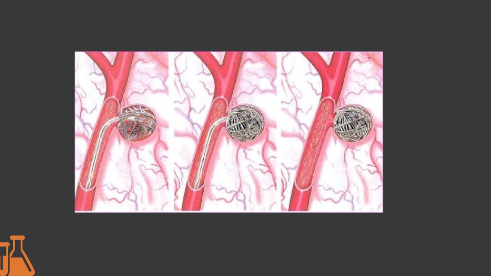 脑血管病介入治疗的护理PPT课件下载4