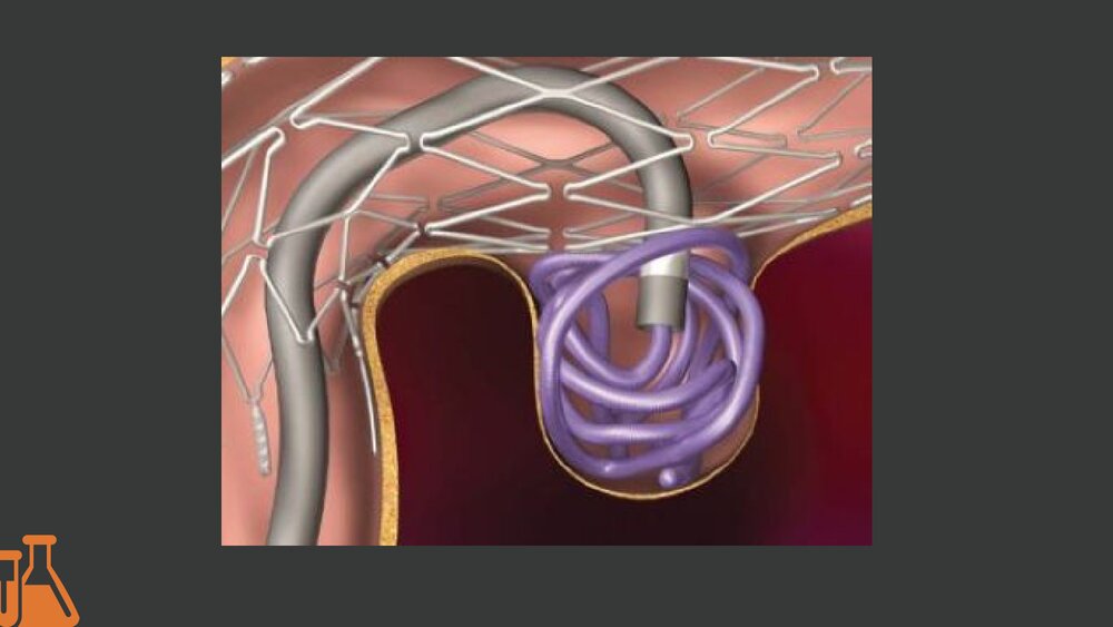 脑血管病介入治疗的护理PPT课件下载5