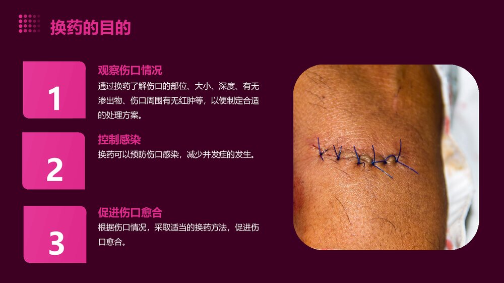 外科换药技术PPT课件下载4