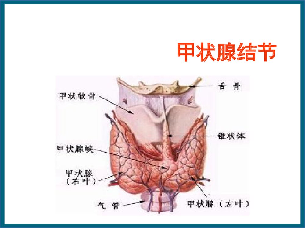 甲状腺结节PPT课件（共63页）1