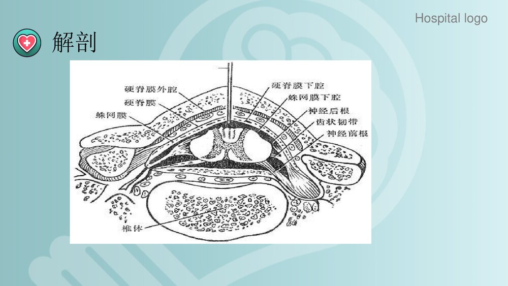 蛛网膜下腔出血PPT课件4