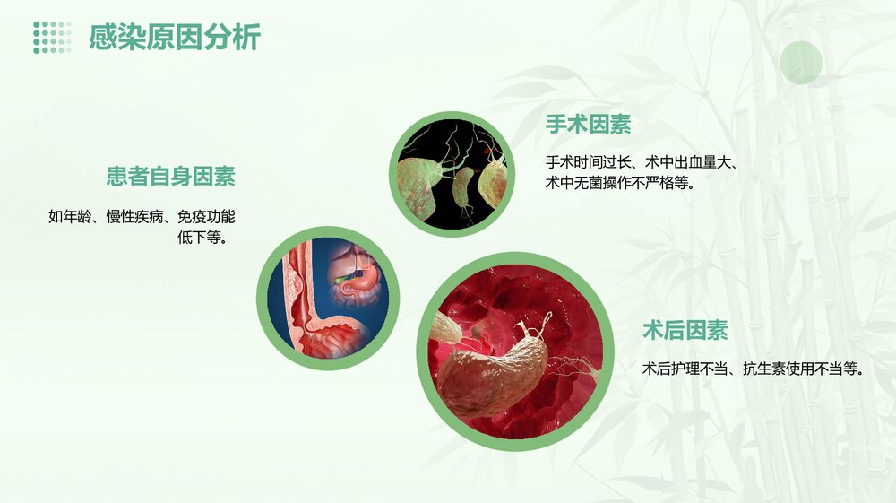 胰十二指肠术后感染的病案讨论PPT课件下载8