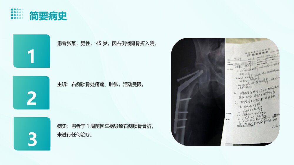 锁骨骨折护理查房PPT课件下载4