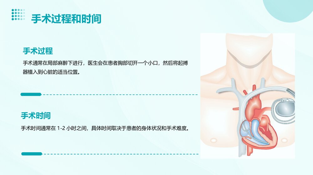 心脏起搏器的护理PPT课件9