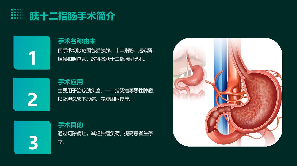 胰十二指肠术后并发症PPT课件下载4