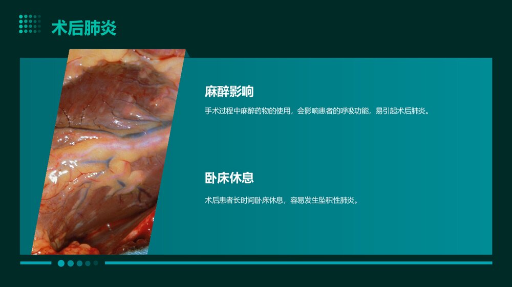 胰十二指肠术后并发症PPT课件下载9