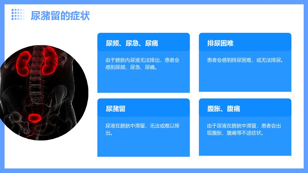 尿潴留的护理查房PPT课件6