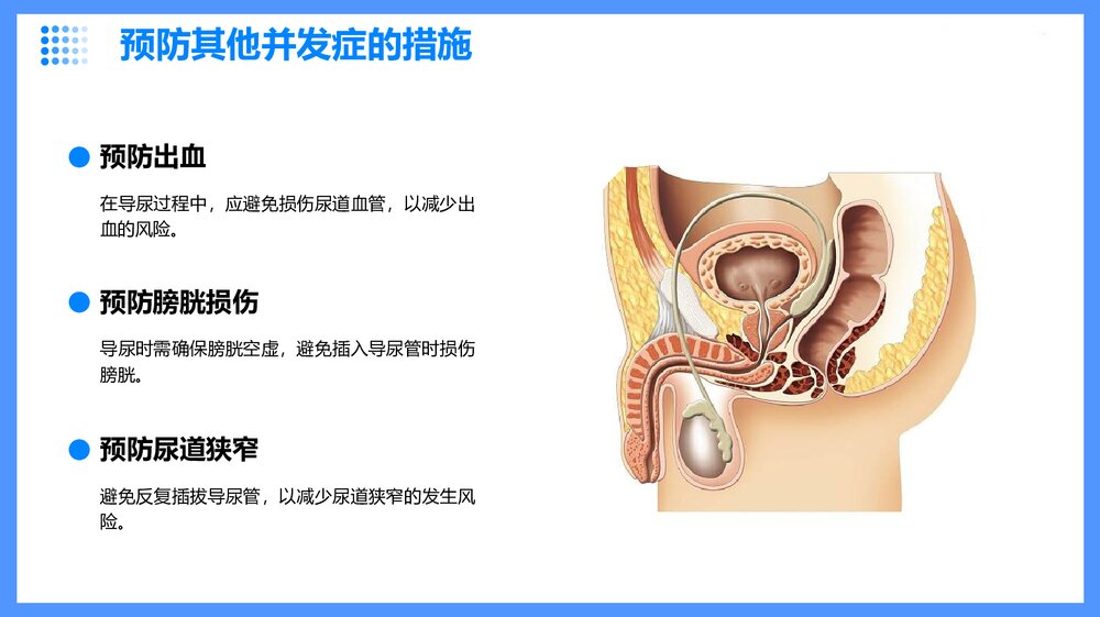 导尿操作并发症的预防及护理PPT课件10