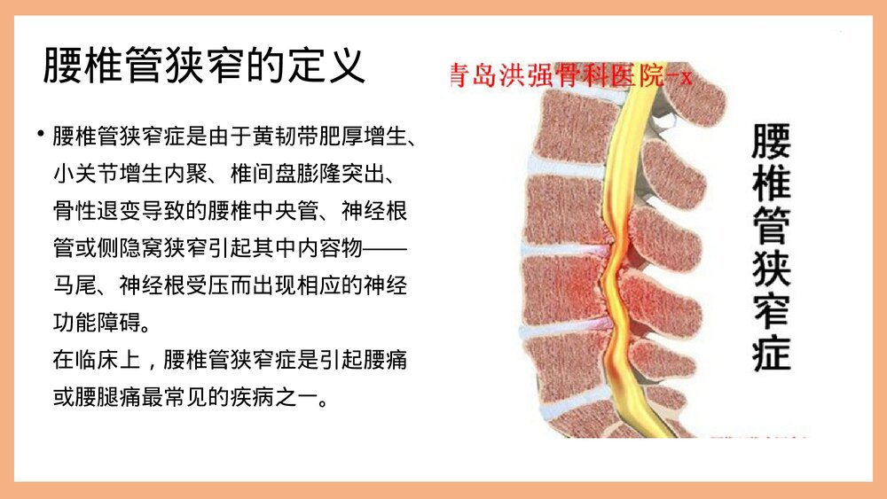 腰椎管狭窄护理PPT课件（共37页·可编辑修改）5