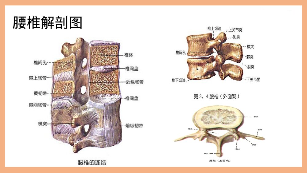 腰椎管狭窄护理PPT课件（共37页·可编辑修改）6