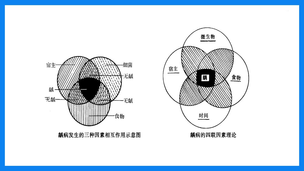 牙体及牙髓病病人的护理PPT课件(共33页·可编辑修改）5