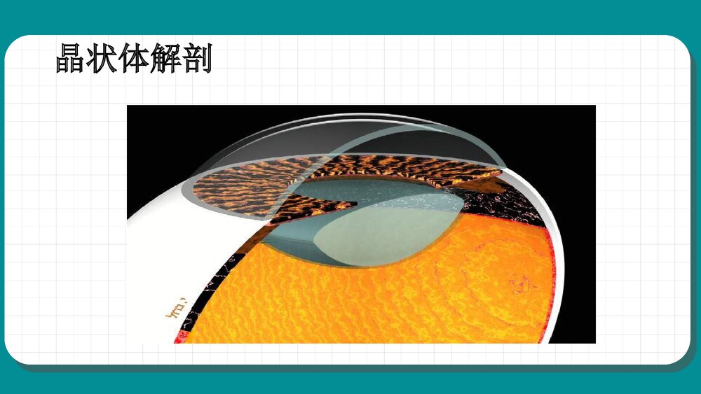 白内障护理查房教学PPT课件（共59页·可编辑修改）3