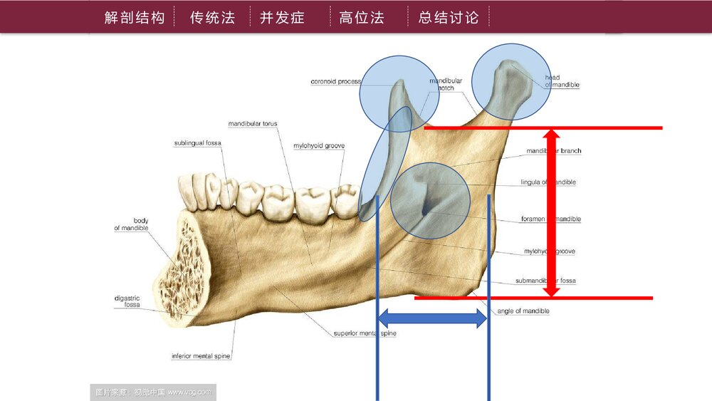 下牙槽神经阻滞麻醉PPT课件下载（共21页·可编辑修改）5