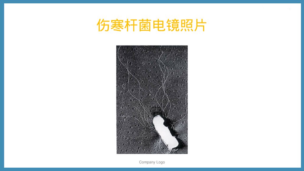 伤寒病人的护理PPT课件下载（共54页·可编辑修改）8