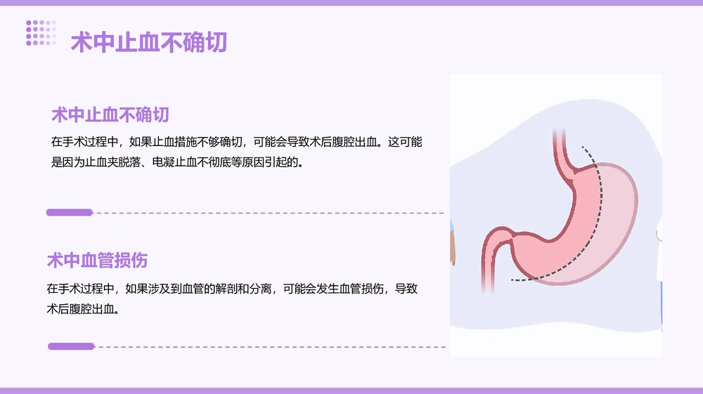 胰十二指肠切除术后腹腔出血PPT课件下载8