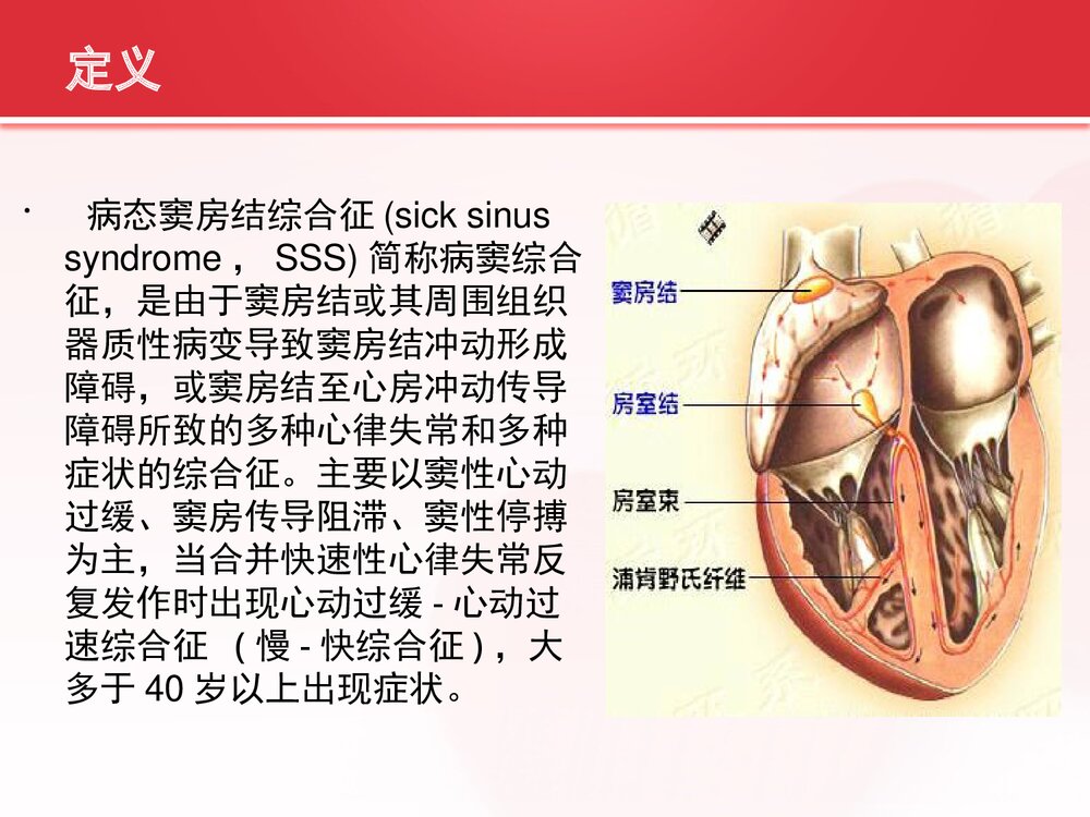 病态窦房结综合症的护理查房PPT课件（共33页可编辑修改）2