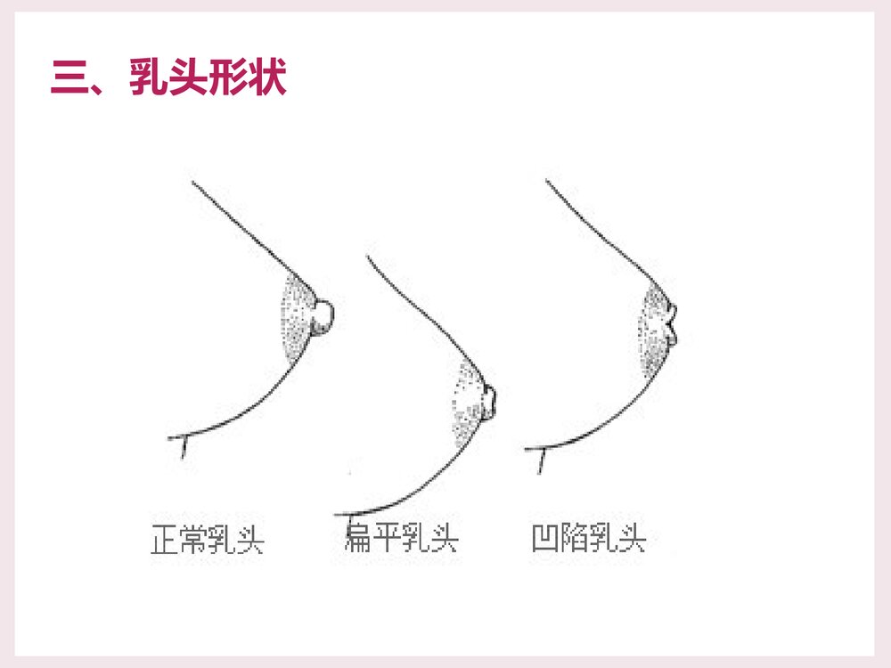 母乳喂养常见问题PPT课件下载7