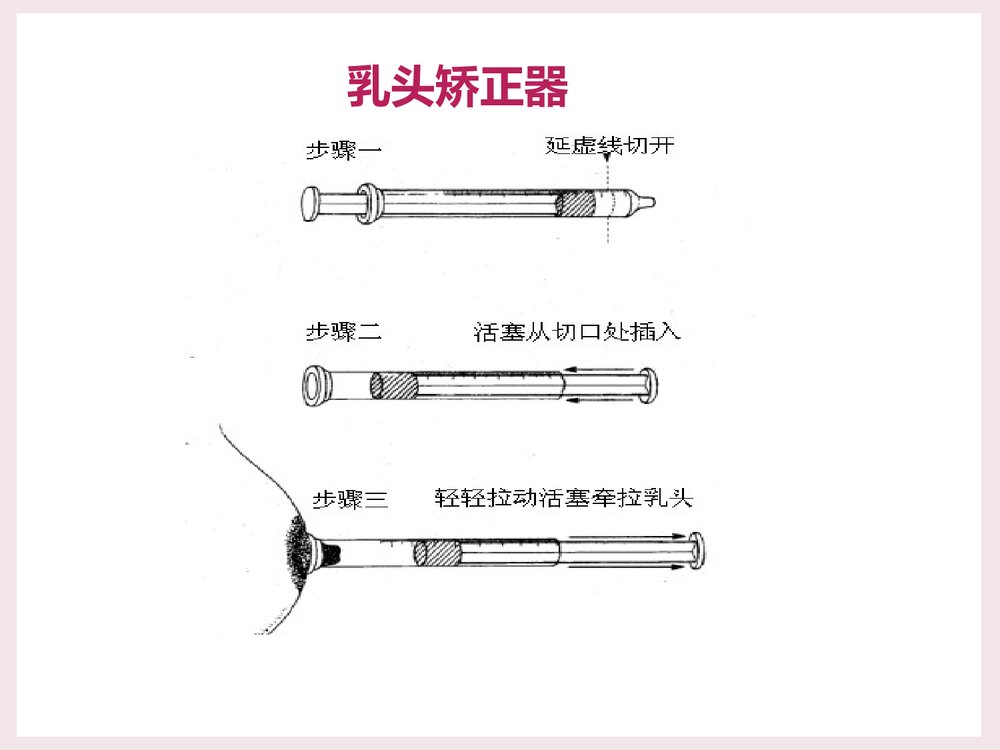 母乳喂养常见问题PPT课件下载9